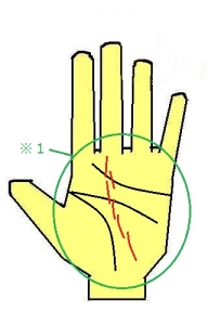 運命線が途切れる
