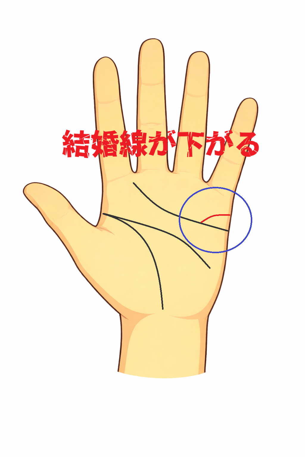 結婚線が感情線方向へ下向きに伸びる手相