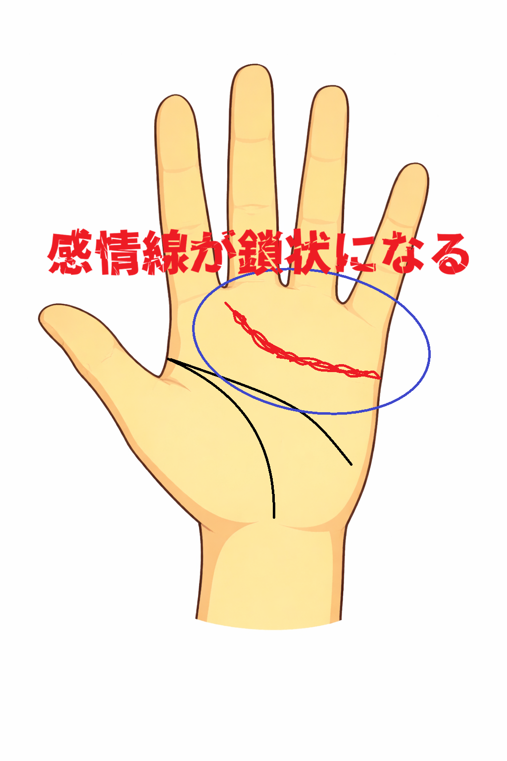 感情線が小さな輪のようにつながる鎖状の手相