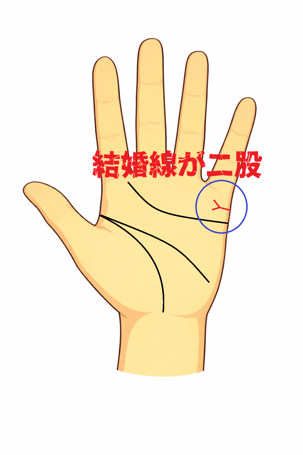 結婚線の先端が二股に枝分かれする手相