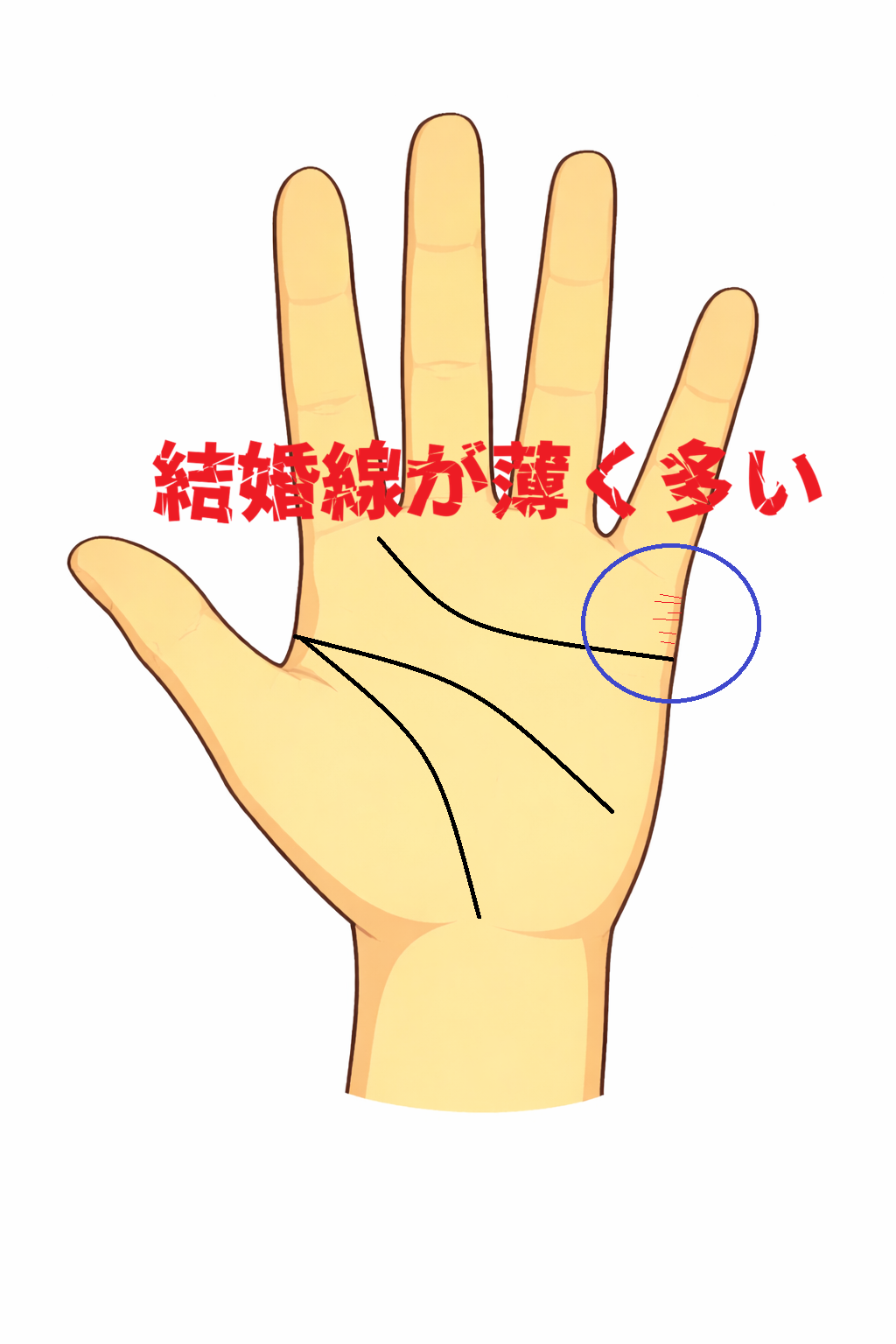 小指の下に薄い結婚線が複数刻まれる手相