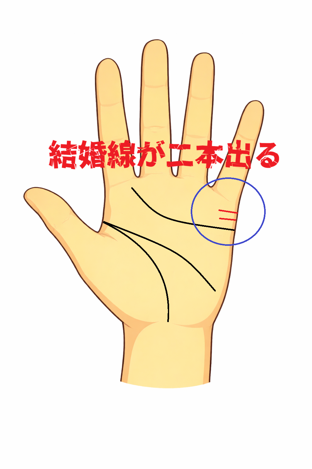 小指の下に結婚線が二本並んで刻まれる手相