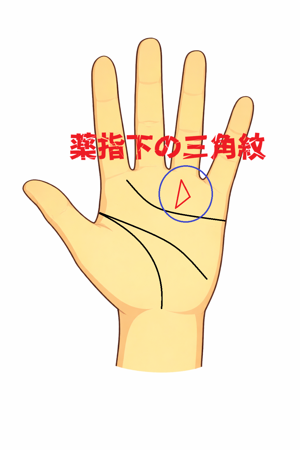 薬指下の太陽丘に閉じた三角形ができる三角紋