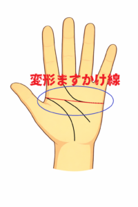 変形ますかけ線がある人の特徴について解説した記事画像
