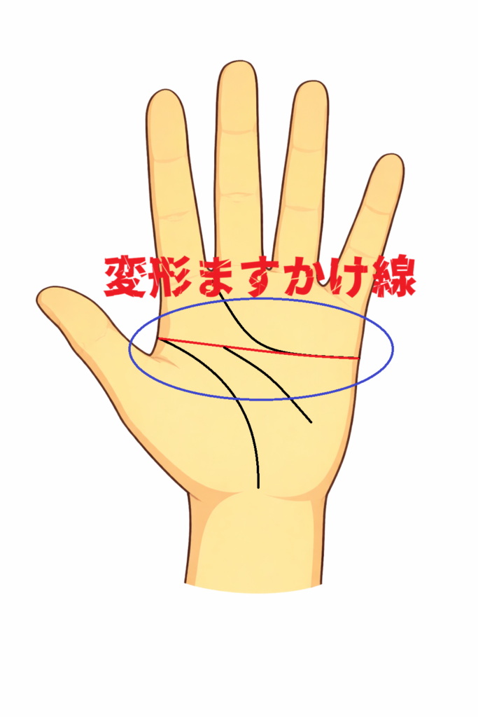 変形ますかけ線がある人の特徴を解説した記事の画像