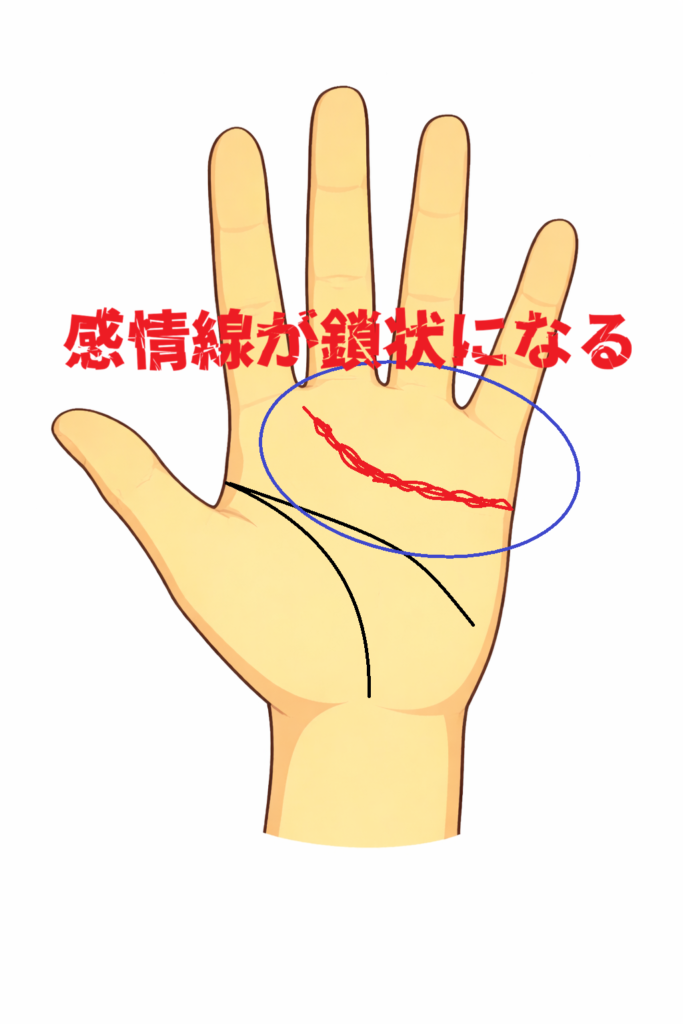鎖状の感情線が出る手相に関する解説記事の画像
