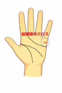 交差（クロス）する結婚線の意味に関する解説記事画像