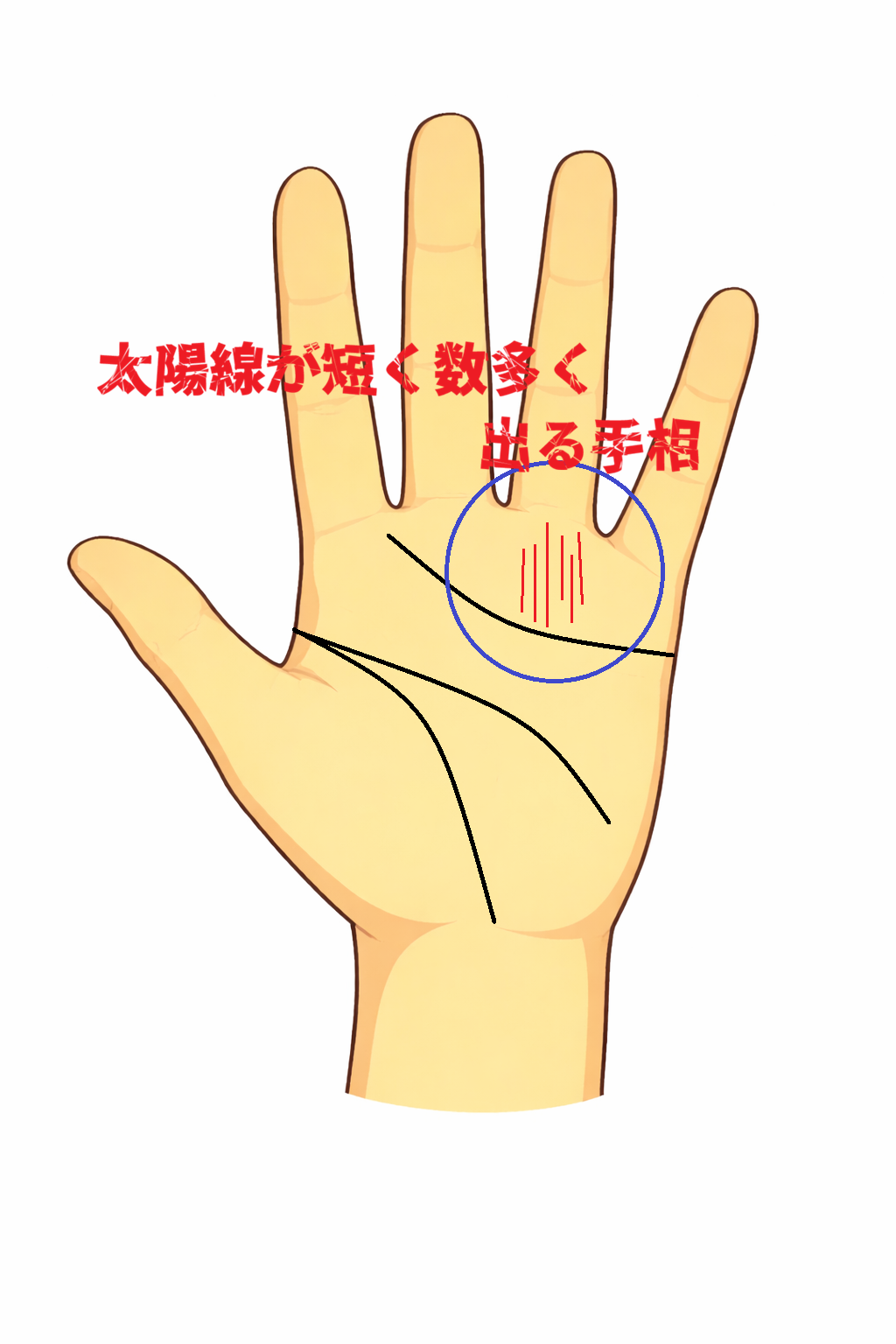 薬指の下に短い太陽線が多数刻まれる手相