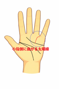 小指側に曲がる太陽線の意味についての解説記事画像